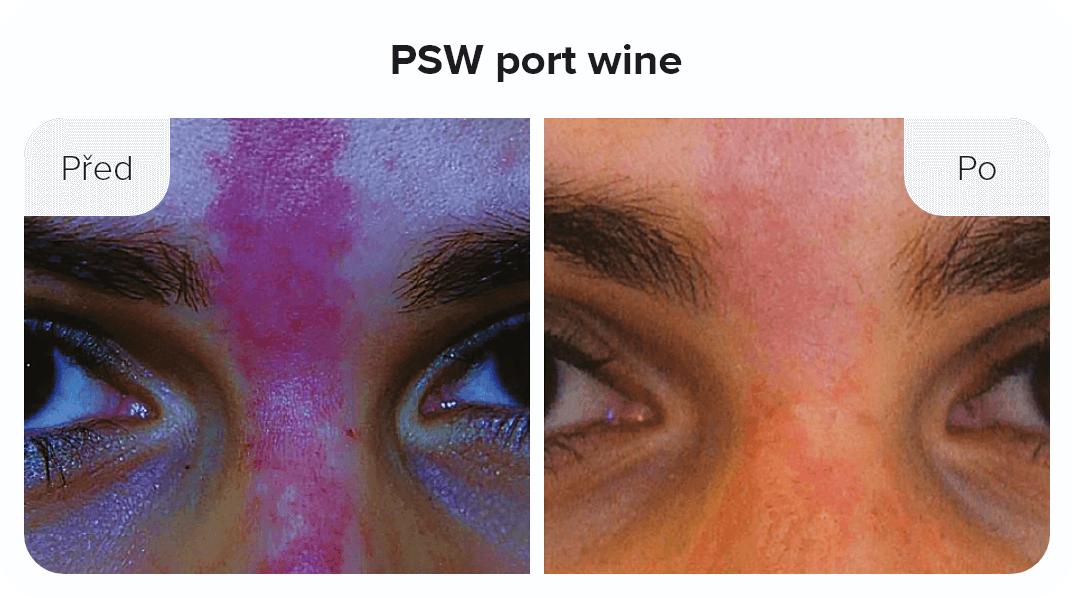 PSW port wine